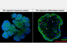 科学家开发出新的类器官模型来研究胸腺功能