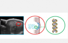强超声提取遗传信息用于微创癌症活检#ASA186