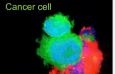 纳米免疫疗法旨在改善肺癌治疗