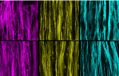 实验室培育的肌肉揭示罕见肌肉疾病的奥秘