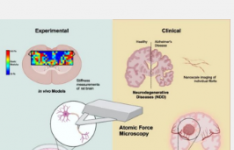 原子力显微镜在神经系统疾病的表征和临床评估中的应用